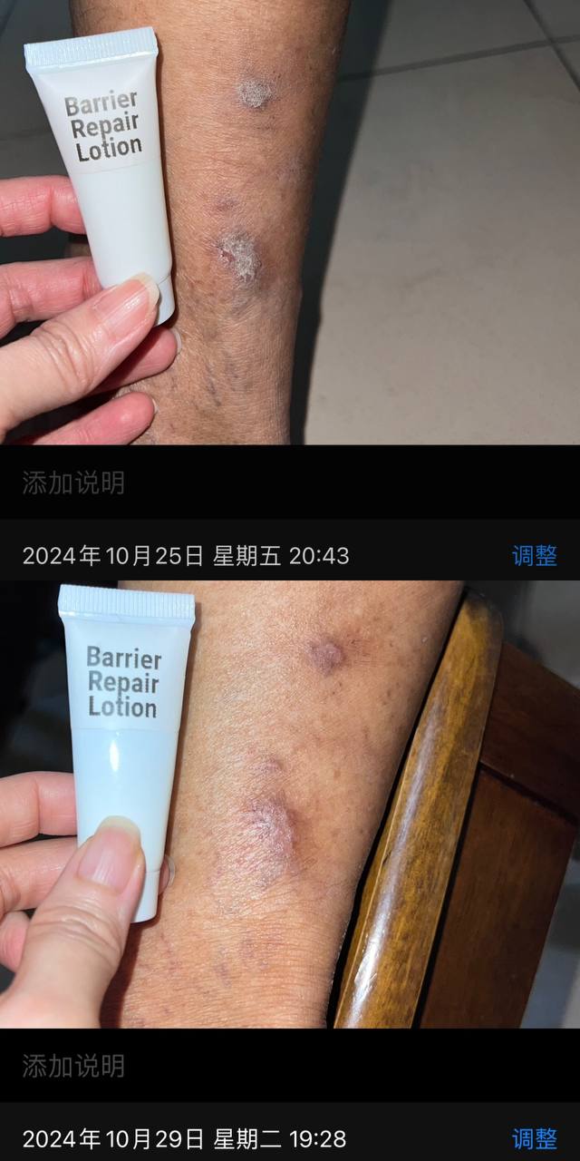 Barrier Repair Lotion – Clinically Proven Relief for Sensitive & Compromised Skin